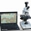 TR3000A digital microscope camera for people