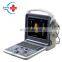 Portable color doppler ultrasound price system/4D ultrasound machine portable