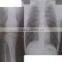 Medical digital x-ray film/DR x ray film/CT X ray film