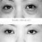 2015 RF eye massage machine lighten eye wrinkles remove black eye