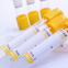 Gel&Clot Activator Tubes Evacuated Blood Collection Serum Tube, Test Tube for Blood Sample Colletion (CE)