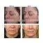 US Tech Real HIFU /high Intensity 5.0-25mm Focused Ultrasound HIFU Face Lifting Machine 4MHZ