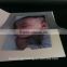 2X2 photo card frame baby wedding graduation folding picture photo frame