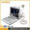 18 months warranty ge Full digital 12-inch LCD monitor laptop ultrasound machine for pregnancy