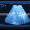 Portable PC platform 3D Ultrasound Scanner diagnosis of Abdomen Cardiac Gynecology Obstetrics Thyroid Gland Small Organs Urology
