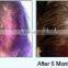 Hair Growth Diode Laser / hair growth laser/ Diode Laser Hair Growth / Hair Loss Treatment