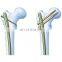 Femoral Intramedullary Nail Set