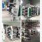 Flexographic Printing Machine for Dual-Sided Printability pp Woven Fabric Printing Machine