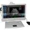 3D Portable ultrasound scanner machinie with touch screen