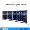 High brightness medical film viewer/x-ray machine types