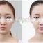 Newest Oxygen Skin Rejuvenation ,pores Removal and Tightening Skin Machine for Salon and Clinic