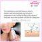 best dead skin removal machine&old skin renmove machine
