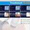 Radial Smart Shock wave therapy Equipment for treatment of osteoarthritis in the horse
