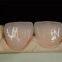 Shenzhen Full service Dental Lab | China Dental Supplier