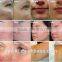 new hot low price led facial equipment omnilux machine led photon light therapy