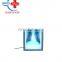 1148 X Ray Machine accessories wall-mounted film viewer single x-ray film viewer