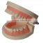 Dental materials dental dental teaching supplies model of dentures dental teeth model