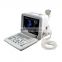 LED Portable Scanner 12inch Diagnostic Black and White Ultrasound with Convex probe