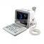 Wholesales Full digital LED Portable Black and White Ultrasound Machine for medical examination