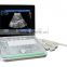 laptop ultrasound machine 3D 4D B ultrasound for pregnancy ob gyn cardiac urology small parts scanning