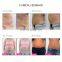 Niansheng factory Portable low price Cryo cellulite reduction slimming machine