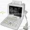 Sonostar High Quality Portable Black and White 12 Inches LCD Screen Ultrasound Machine Sale SS-4