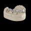 Dental-Implants china outsourcing dental lab