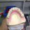 Implant Zirconia Crown and Bridge - China Dental Lab of Good Quality and Professional Technicians