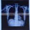 X-ray film the most popular China supper supplier standard medical film