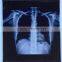 medical supplies fuji,agfa medical dry film