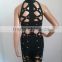Summer dress wholesale dropship 2015 new black hollow out sleeveless high neck three pieces set sey women mini evening party ban