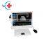 HC-A005 New Portable Digital B Ultrasound for Pregnant Women/hospitals,etc.