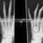 medical surgical film x ray film fuji diht for hospital use