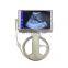 Ultrasound Machine Dual Head for Android usb ultrasound linear probe price