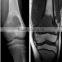 hot selling good quality Konida use fuji dry film medical x-ray film