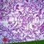 Fixed items Factory Direct Sale High Quality Pathology Microscope Prepared Slides