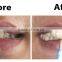 Magic Brush Teeth Cleaner