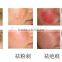 YUWEI Medical Electronic Pulse Face Eye Wrinkle Removal Eye Care Massage