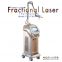 CO2 fractional laser for removing pore and pigment