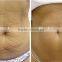 Fat Melting Able Cryolipolysis Slimming Reshaping Machine/cryotherapy Portable/cryotherapy