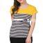 High Quality Women Summer Appeal Cute Shirts Special T Shirt For Ladies Fashion Style T-Shirts Women's
