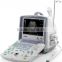 Laptop Doppler portable ultrasound machine price CE certified medical equipment used in hospital