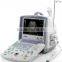 Laptop Doppler Ultrasound Scanner-CE certified medical ultrasound machine