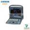 medical b/w 2d portable ultrasound Chison eco1
