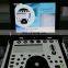 MY-A039B Portable Cardiac Ultrasound System Color Doppler Ultrasound Machine Scanner Price with Ultrasound Probe