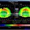 High-technology MCT Treatment of myopia and amblyopia