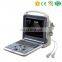 Newest MY-A025 Portable 4D Cardiac color doppler ultrasound scanner