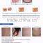 0.1-2.6mm 30w Cutting/beauty/Virginal Mode Rf Tube Co2 Fractional Laser Scar Removal Machine Ultra Pulse