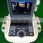 2015 Hot Selling 4D Real Time Color Doppler with CE ISO