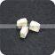 High precision insulating 99% alumina ceramic car part 99 alumina air valve disc